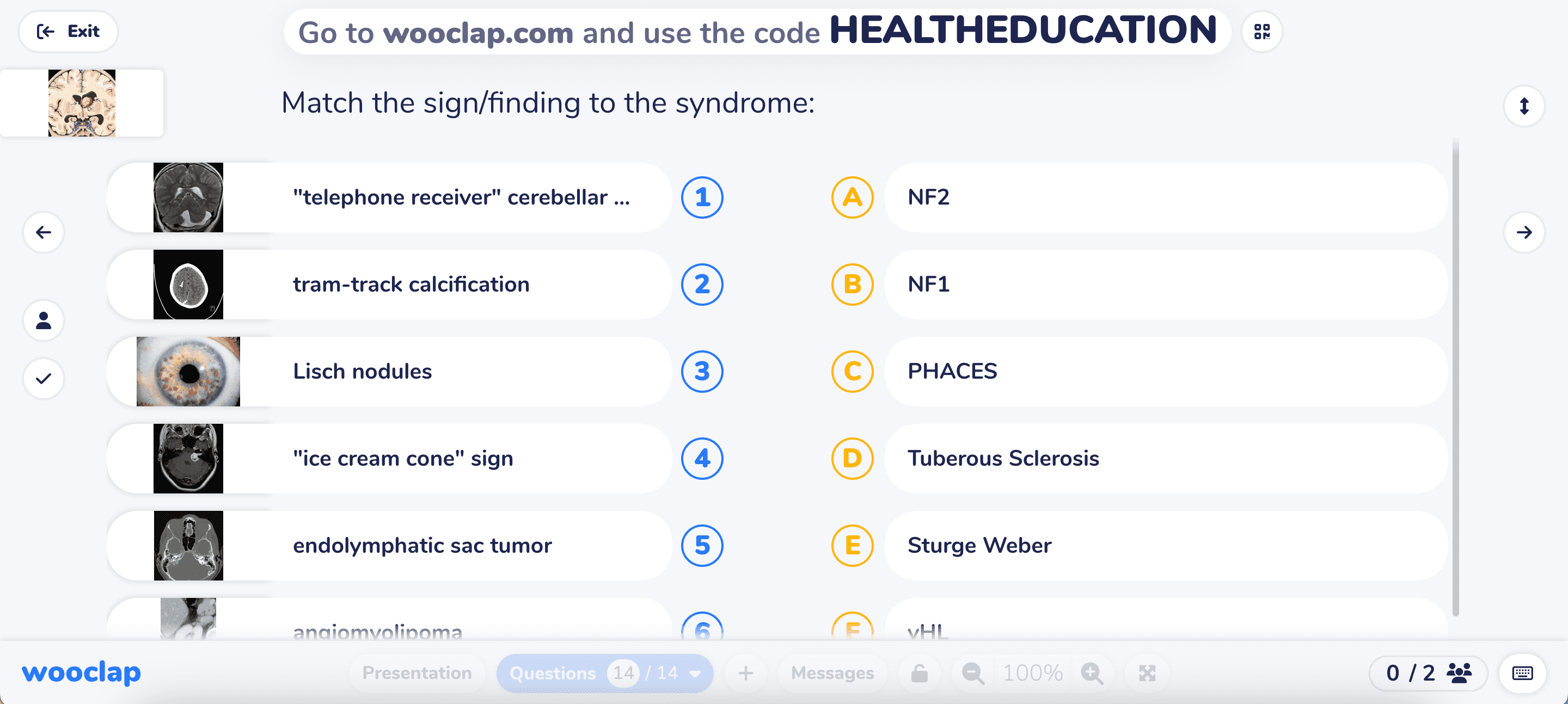 Students match diagnostic signs or imaging findings to the correct syndromes 